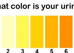 why is my urine yellow?